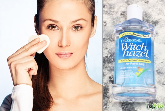 10 incredible ways you can use witch hazel