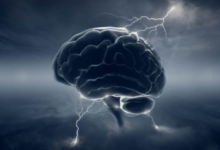 Why iot needs ai