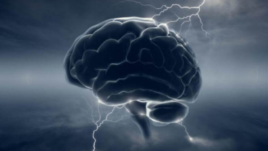 Why iot needs ai
